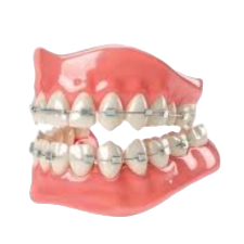 brace-bgremove